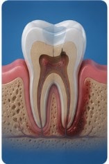Can a Root Canal Fail?