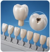 What Is the Difference Between Cosmetic and Restorative Dentistry?