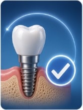 Who Is a Good Candidate for Implants?