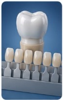 What Are Dental Crowns Made Of?