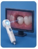 What Are Intraoral Cameras?